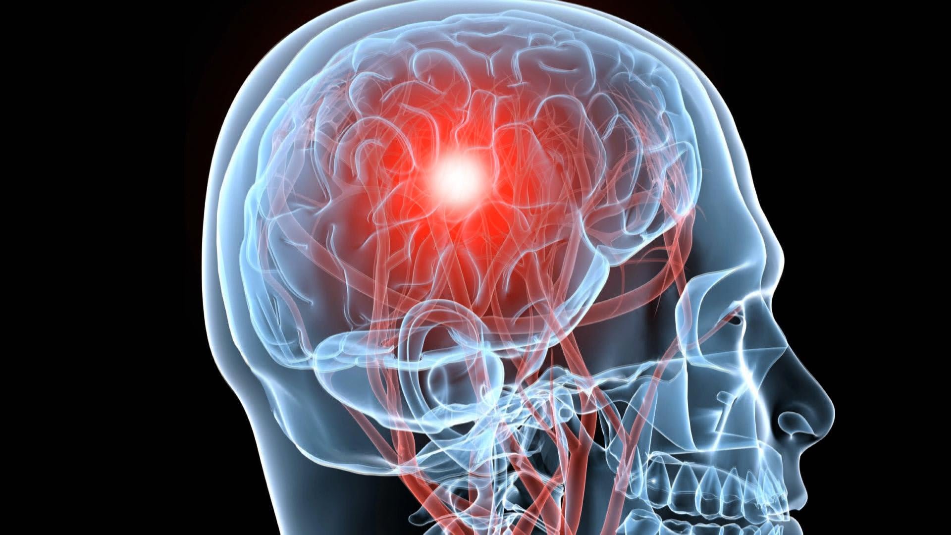 can-symptoms-of-traumatic-brain-injury-show-up-years-after-an-injury